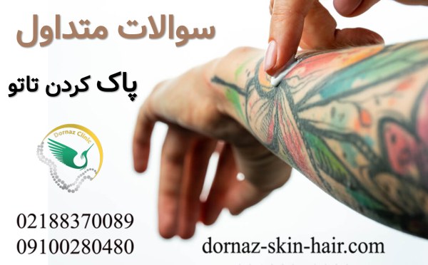 سوالات ریمو تاتو ریمو تاتو ابرو ریموو تاتو بدن تتو