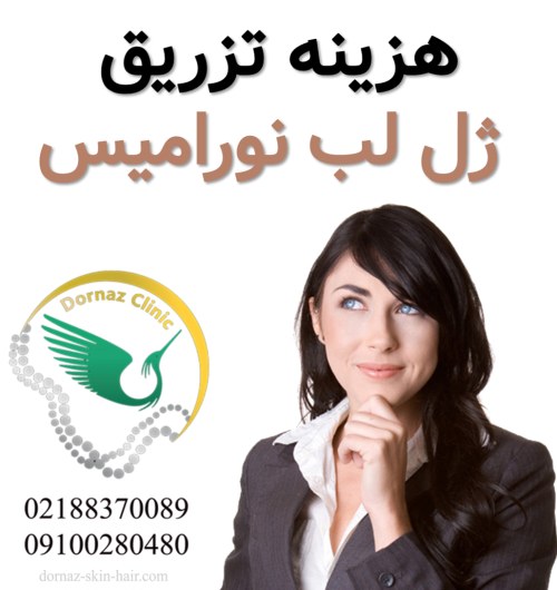 قیمت هزینه تزریق ژل لب نورامیس