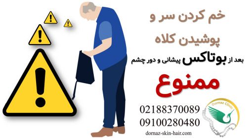 خم کردن سر بعد از بوتاکسافتادگی پلک بعد از بوتاکس