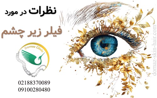 نظرات در مورد فیلر زیر چشم