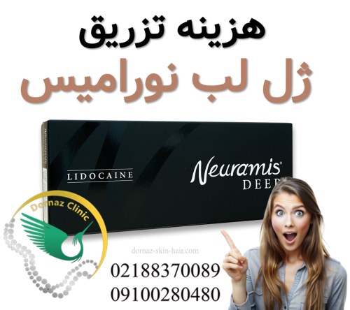 قیمت تزریق ژل نورامیس