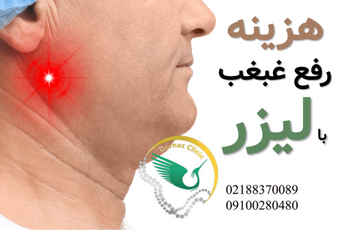 هزینه رفع غبغب با لیزر