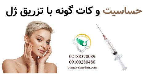 آیا کات گونه با تزریق ژل باعث حساسیت پوستی می‌شود؟