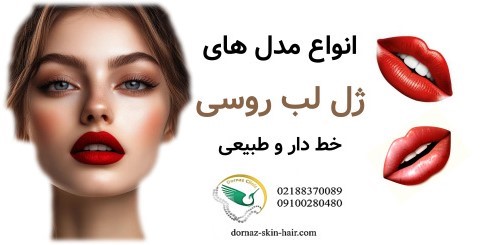 انواع مدل های ژل لب روسی خطدار و طبیعی