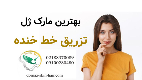 بهترین مارک ژل تزریق خط خنده