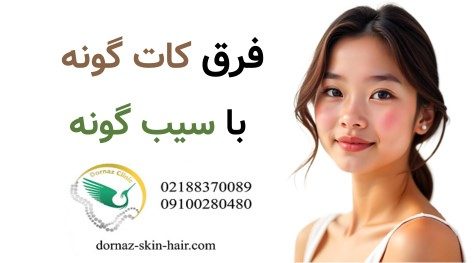فرق کات گونه با سیب گونه