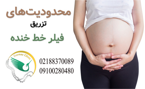محدودیت های تزریق فیلر خط خنده