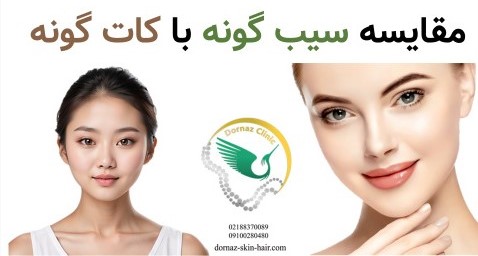 مقایسه کات گونه با سیب گونه