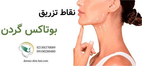 نقاط تزریق بوتاکس گردن