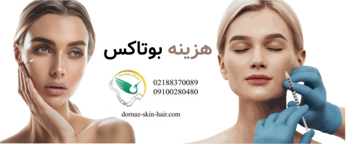 هزینه بوتاکس چقدر است؟