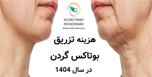 هزینه بوتاکس گردن