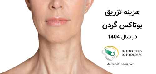 هزینه تزریق بوتاکس گردن در سال 1404