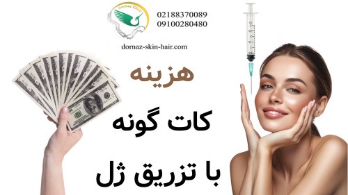 هزینه کات گونه با تزریق ژل چقدر است؟