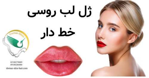 ژل لب روسی خط دار