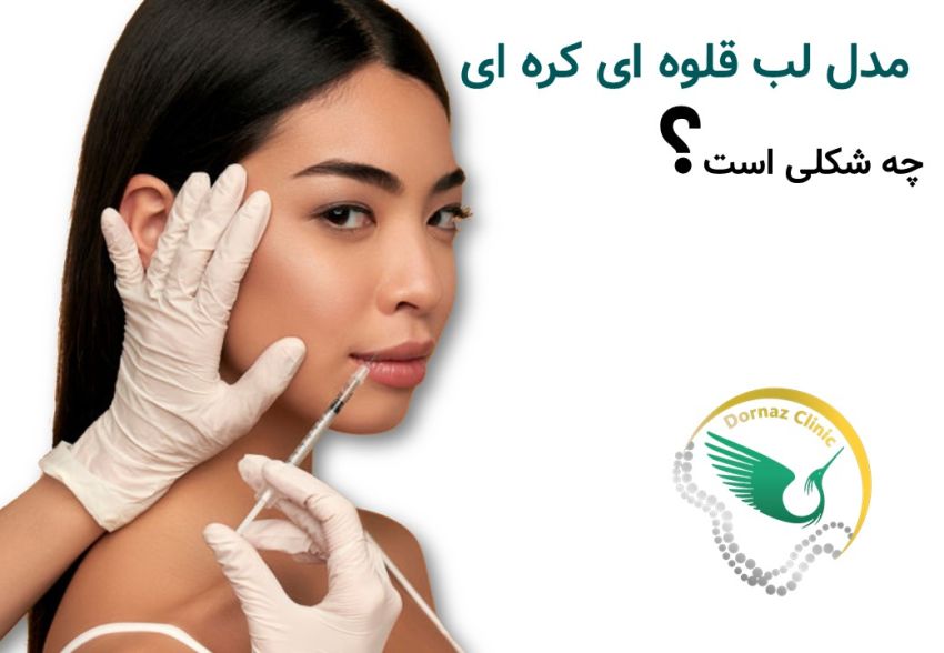 مدل لب قلوه ای کره ای