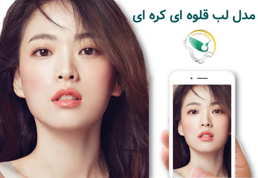 لب کره ای