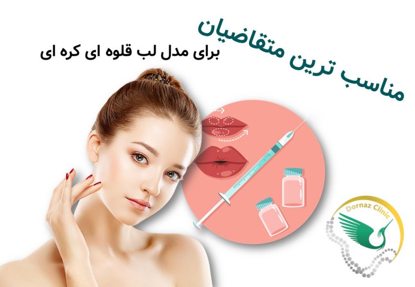 مناسب ترین متقاضی مدل لب قلوه ای کره ای