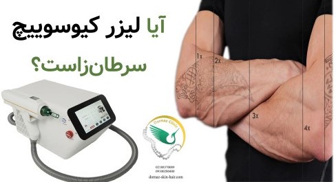 آیا لیزر کیوسوییچ سرطان‌زاست؟