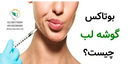 بوتاکس لب و گونه چیست؟