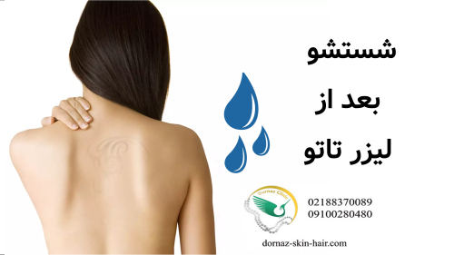 شستشو بعد از لیزر تاتو