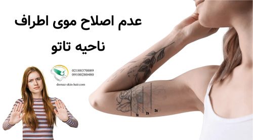 عدم اصلاح موی اطراف ناحیه تاتو