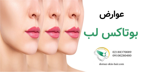 عوارض بوتاکس لب