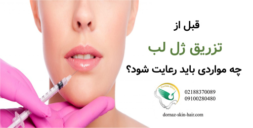 قبل از تزریق ژل لب چه مواردی باید رعایت شود