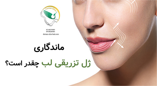 ماندگاری ژل تزریقی لب چقدر است و به چه چیزهایی بستگی دارد؟