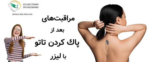 مراقبت‌هاي بعد از پاك كردن تاتو با ليزر‎