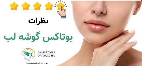 نظرات بوتاکس گوشه لب