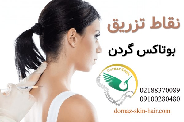 نقاط تزریق بوتاکس گردن