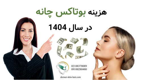 هزینه بوتاکس چانه سال 1404