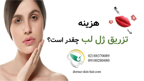 هزینه تزریق ژل لب چقدر است؟