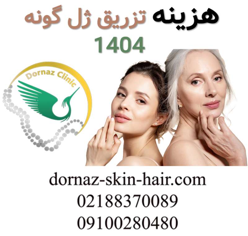 هزینه تزریق ژل گونه در سال 1404 چگونه است؟ قیمت ژل گونه