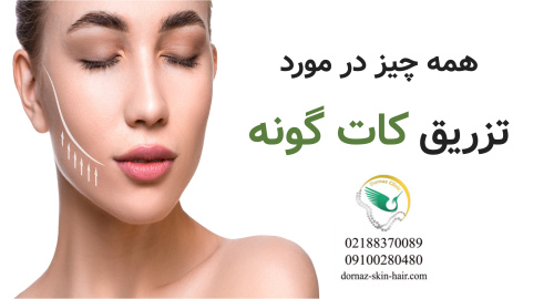 همه چیز درباره تزریق کات گونه در تهران