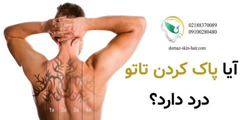 پاک کردن تاتو درد دارد؟