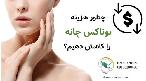 چطور هزینه بوتاکس چانه را کاهش دهیم؟