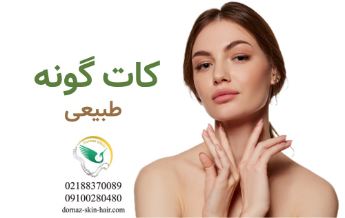 کات گونه طبیعی