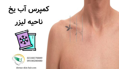 کمپرس اب یخ ناحیه لیزر