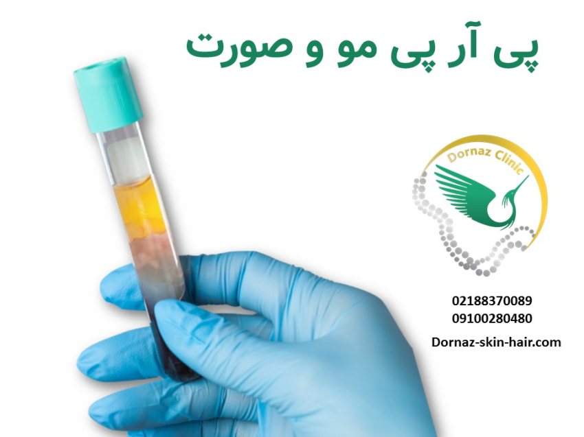 پی آر پی