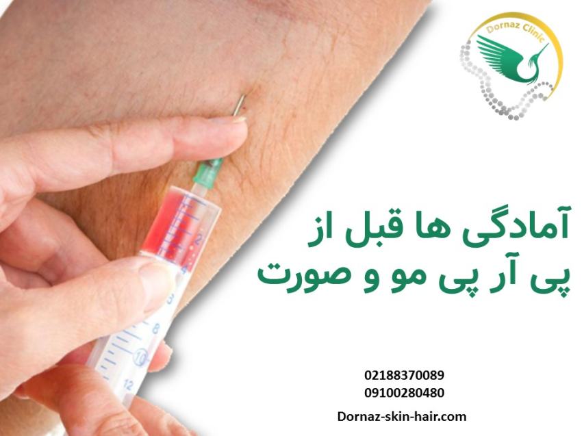آمادگی های قبل از پی آر پی