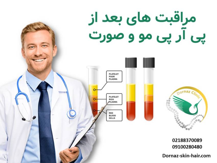 مراقبت های بعد از پی آر پی