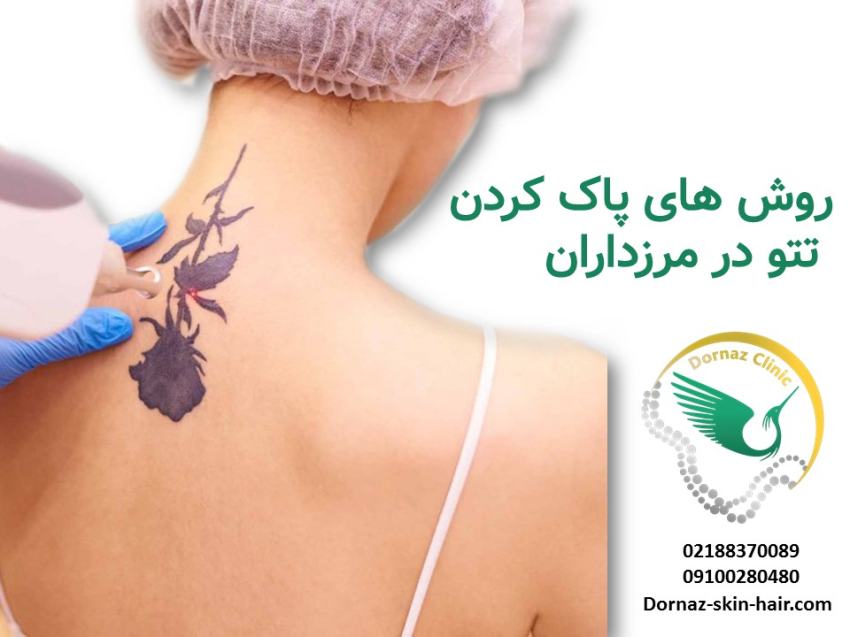 لیزر درمانی پوست