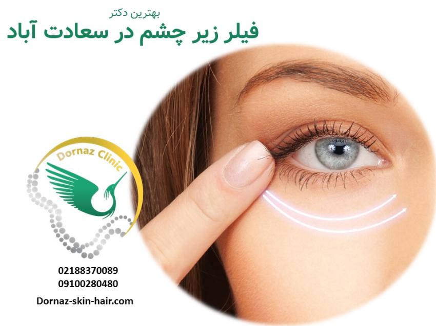 فیلر زیر چشم