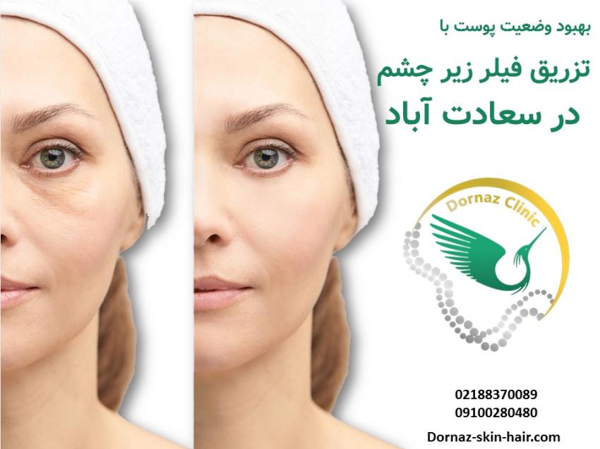 بهبود وضعیت پوست