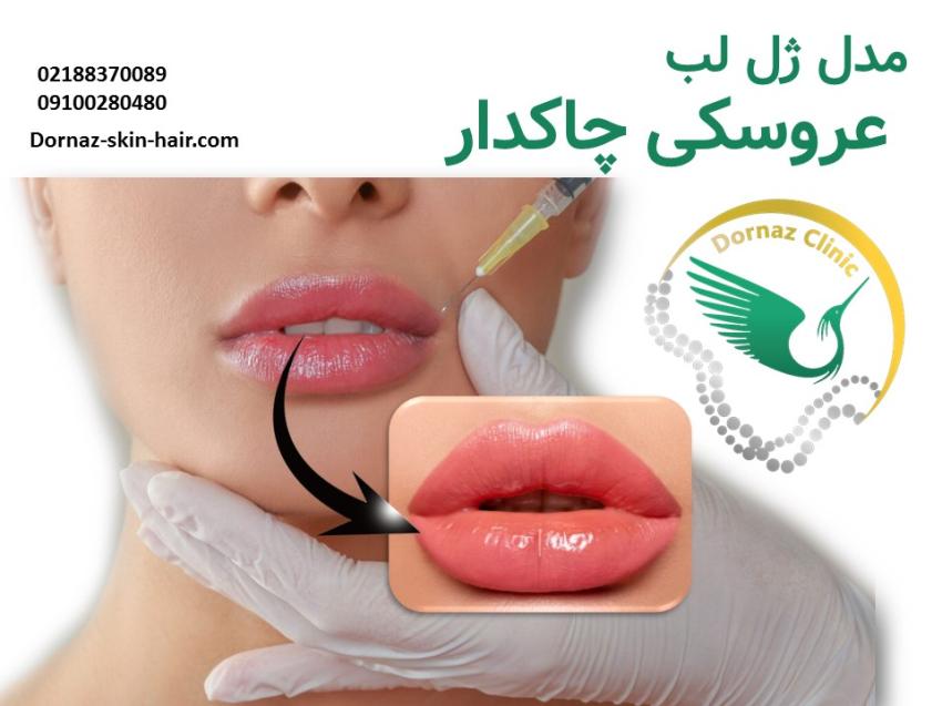 ژل لب مدل عروسکی چاکدار