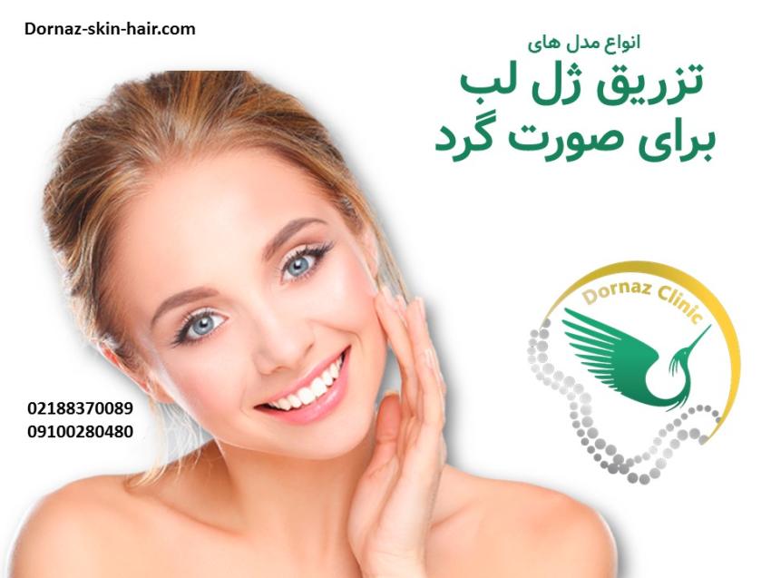 انواع مدل لب برای صورت گرد