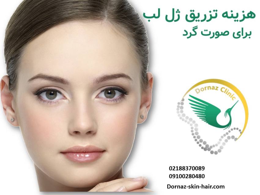 هزینه تزریق فیلر لب