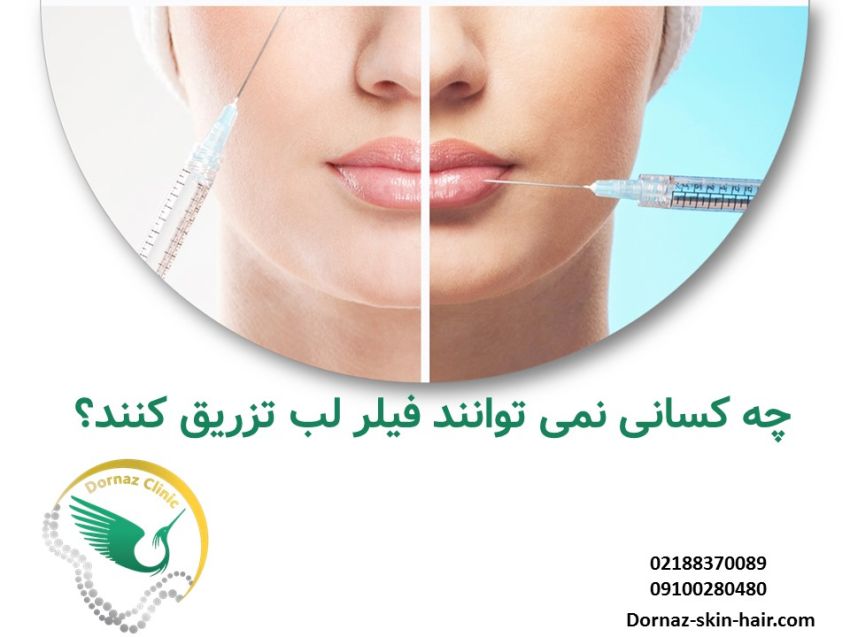ممنوعیت های تزریق فیلر لب