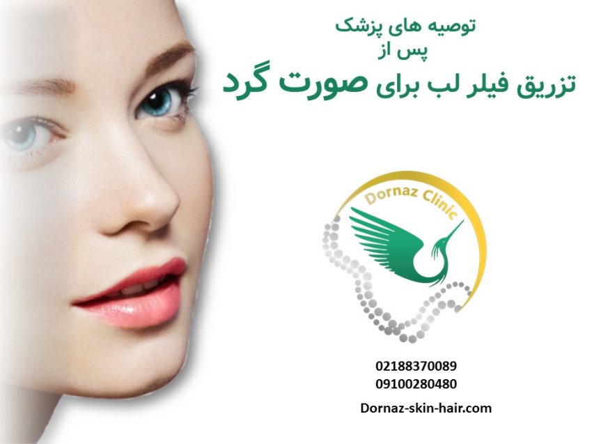 مراقبت های بعد از فیلر لب